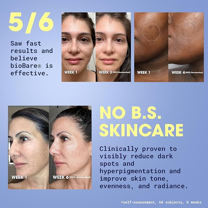 bioBare® Vitamin C, B, E & Ferulic Serum | 20% Pure Vitamin C Facial Serum with Hyaluronic Acid, Niacinamide & Ferulic Acid | L-Ascorbic Acid Serum for Dark Spots, Fine Lines, Wrinkles, Uneven Skin