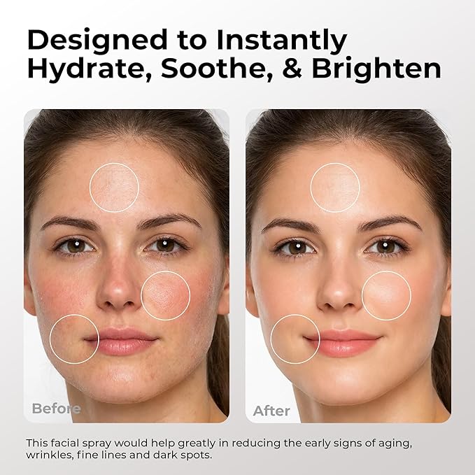 SKIN DEVA Hyaluronic Acid & Argireline Facial Spray – Hydrating Face Mist with Lavender Extract – Helps Improve the Appearance of Fine Lines – Lightweight Moisture Boost for All Skin Types (Rose)