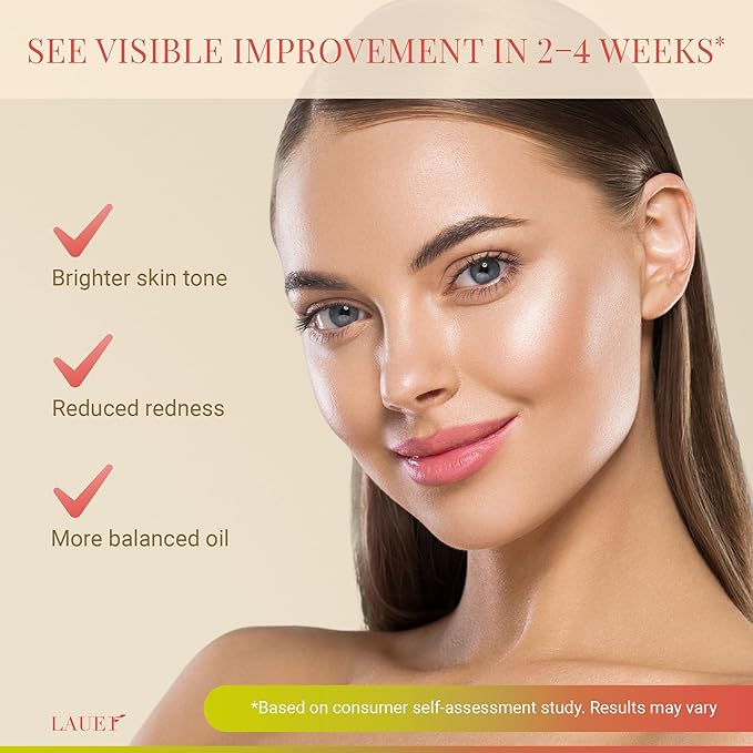 Azelaic Acid Face Serum 10% for Women – Brightening & Clarifying Facial Serum with Niacinamide, Vitamin C, Hyaluronic Acid & Jojoba Oil – Redness & Dark Spot Balancing, 1 fl oz