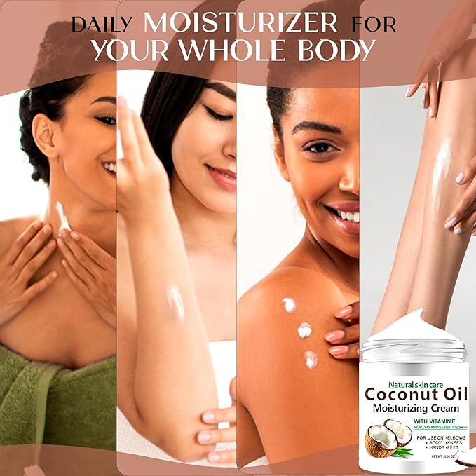 Coconut Cream 300ml – Moisturizing Body Lotion for Dry Skin – Nourishing Cream for Skin & Body – Natural Coconut Moisturizer for Women & Men
