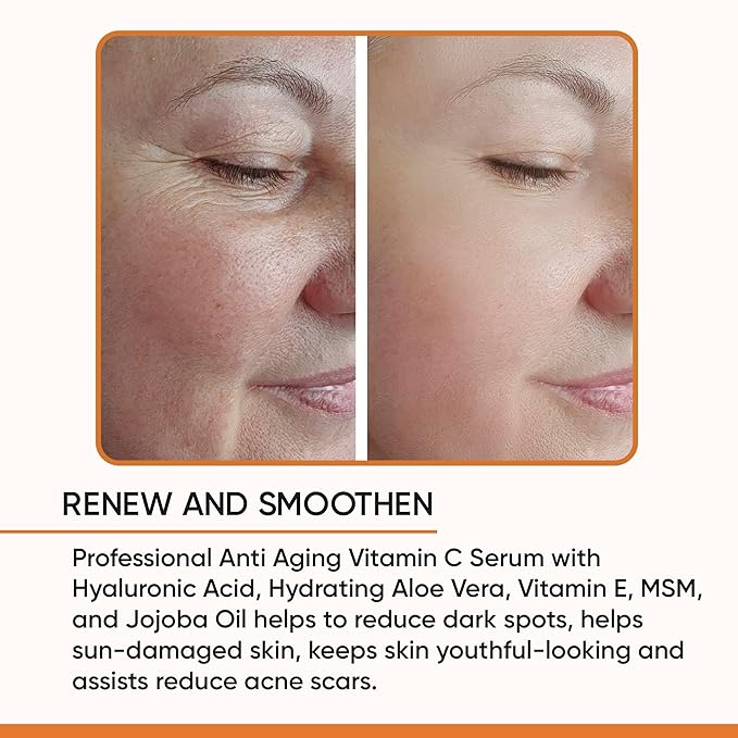 100% PURE VITAMIN C SERUM FOR FACE, Anti Aging Serum with Hyaluronic Acid, Vitamin E, MSM, Hydrating Serum for Dark Spots, Fine Lines, Wrinkles, Organic Vegan Ingredients - DOUBLE SIZED (2 OZ)