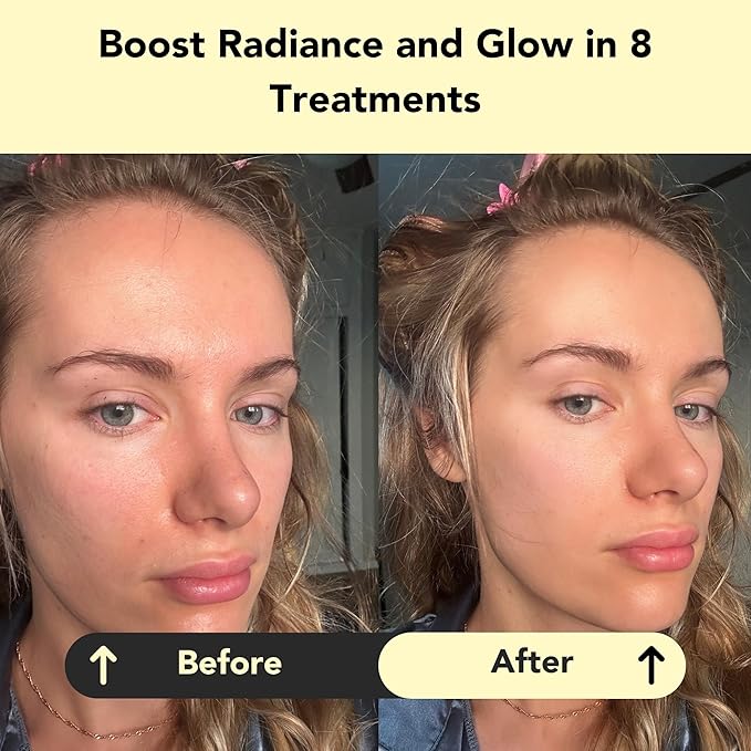 Glorio GLOW: 8 Revitalizing Clay Face Mask Treatments - Rare Gold Clay - 8 Week Beauty Set - Boost Radiance & Luminosity - Vitamin C, Indian Healing Clay, Skin Care Gift, Self Care, Skincare Women Men