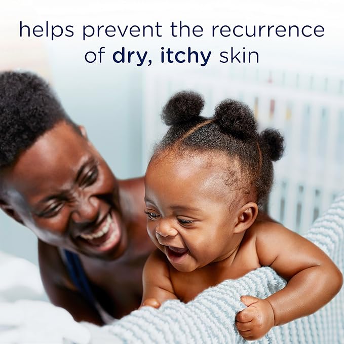 Baby Dove Soothing-Cream To Soothe Delicate Baby Skin Eczema Care No Artificial Perfume or Color, Paraben Free, Phthalate Free 5.1 oz (Pack of 2)