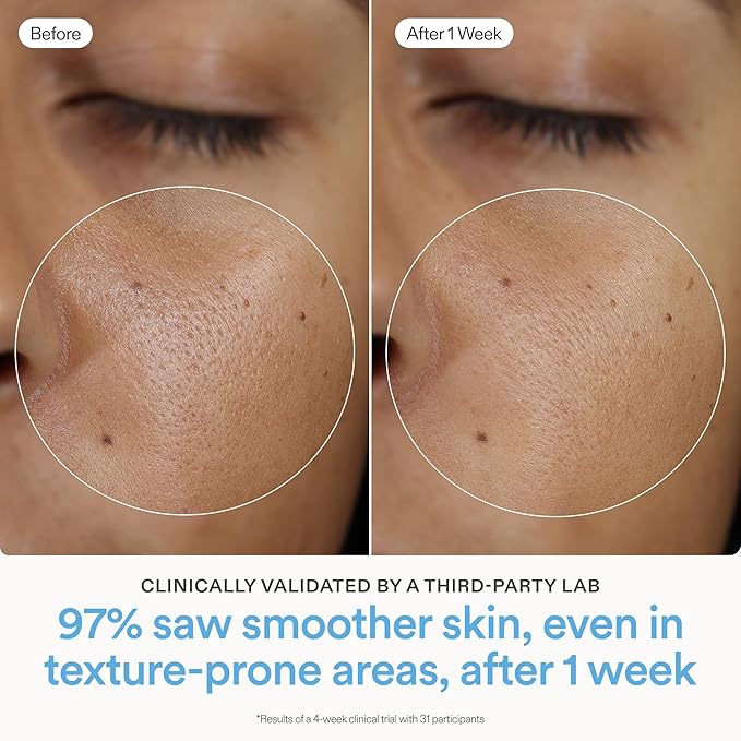 Skinfix Ceramide Prime Whipped Cream - 1.7 oz - Lightweight Moisturizer for Face with Niacinamide + Peptides - Non-Comedogenic, Fragrance Free, Vegan, Cruelty Free