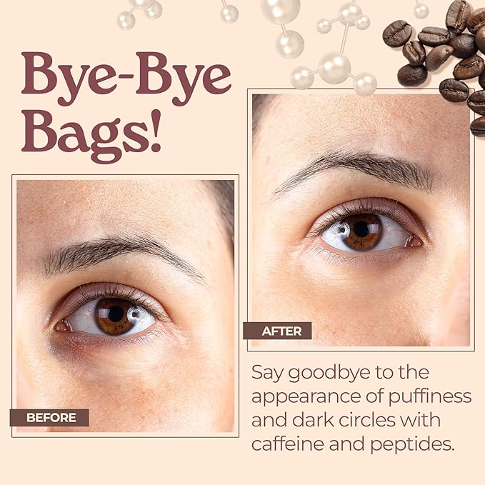 Tree To Tub Caffeine Eye Cream - Hydrating & Firming Under Eye Cream for Dark Circles, Eye Roller for Puffy Eyes, Reduces the Look of Puffiness and Bags, Coffee Eye Cream w/Hyaluronic Acid, Peptides