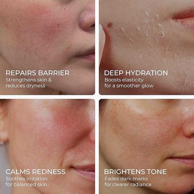 Organic Barrier Repair Face Oil, Deep Hydration & Redness Soothing, Firming & Brightening with Squalane, Niacinamide, Vitamin E & Rosehip Seed Oil, Gua Sha Oil for Dry & Sensitive Skin