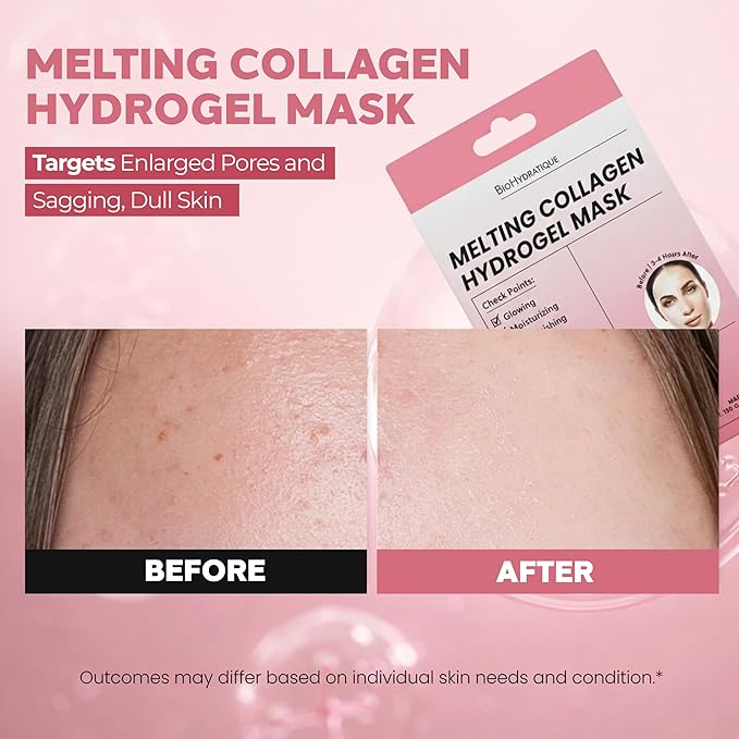 Hydrogel Collagen Face Mask – Overnight Hydrating & Firming Treatment for Dry or Mature Skin – Dermatologist Tested, Anti Aging Korean Skin Care, Vegan, Clean Beauty – Pack of 5