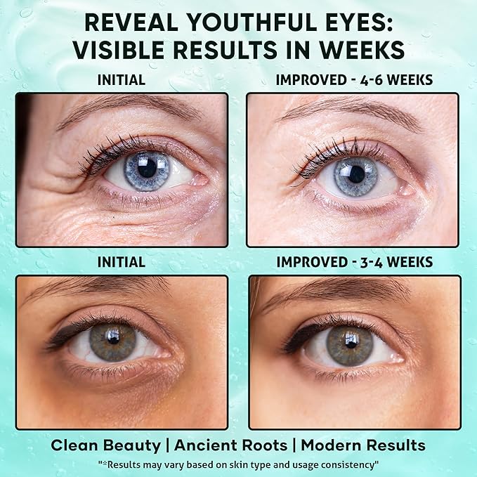Bakuchiol, Caffeine Under Eye Milky Serum for Dark Circles, Puffiness & Fine Lines with Peptides & Ectoin - Brightening & Hydrating Lightweight Plant-Based Vegan Formula 15ml