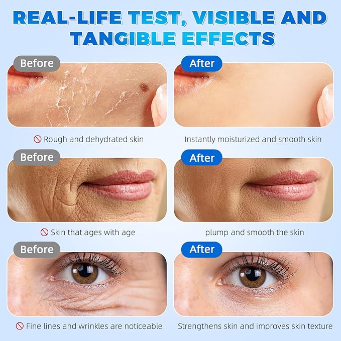 3% Hyaluronic Acid Serum Ultra-Hydrating Vials 30 pcs - 3% Hyaluronic Acid Serum For Face - Single Use Hyaluronic Acid Tubes - Intensive Moisturizing, Skin Tightening, Emergency Repair, Anti-Aging