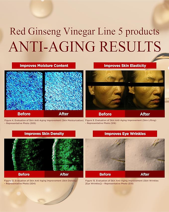 Danahan Bonyongo Red Ginseng Vinegar Eye Cream 1.01oz – Korean Anti Aging & Firming Under Eye Treatment Cream for Youthful Radiant Skin - Helps Reduce the look of dark circles, Puffiness & Finelines