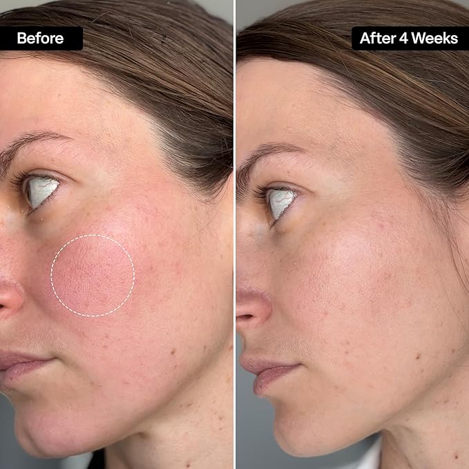 QRxLabs Squalane Oil for Face - Hydrating Face Oil for Women with Vitamin E - Dermaplaning & Gua Sha Massage - Moisturizer for Oily Skin - Unscented, 2 Fl Oz