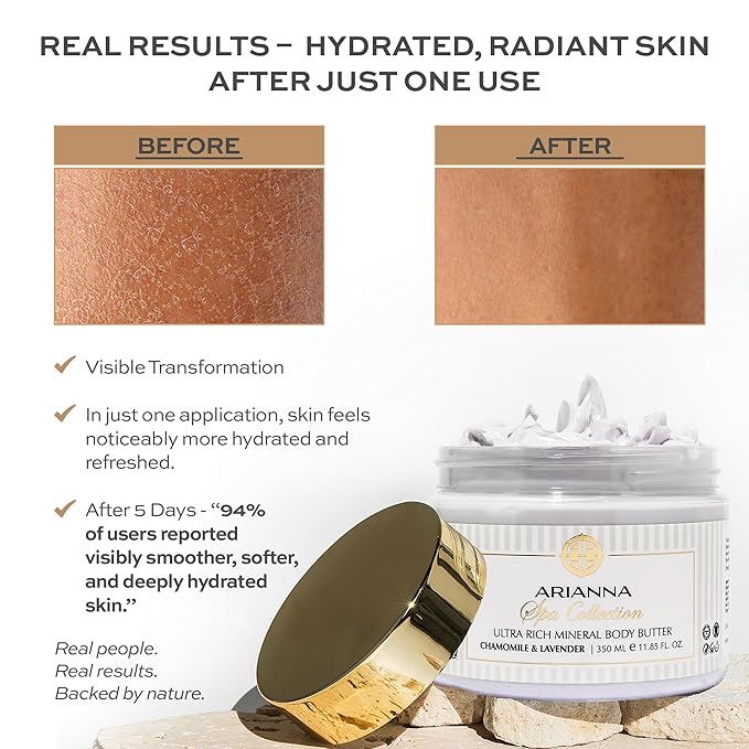 Ultra Rich Mineral Body Butter Dead Sea Body Butter For Dry Skin Repair Rich Vegan Hydrating Moisturizer (Citrus & Forest Fruits)