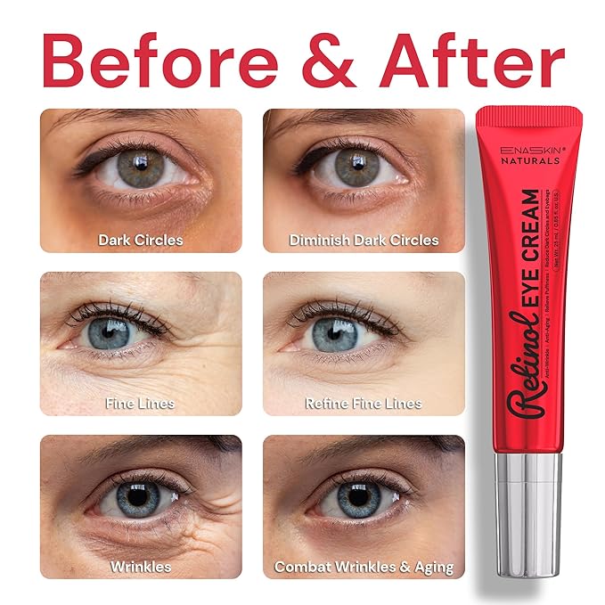 Retinol Eye Cream Anti Aging: Under Eye Wrinkle Repair for Women - Instant Tightening & Smoothing Eye Contour Fine Lines - Reduces Dark Circles, Puffiness, Eye Bags, 0.85 fl.oz