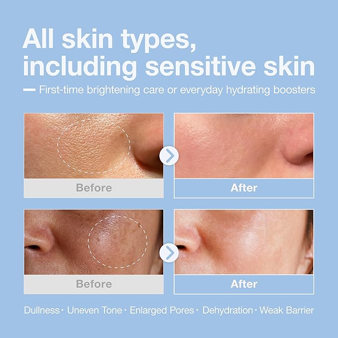 Niacinamide + Hyaluronic Brightening Deep Dive Serum,10% Brightening Complex, Deep Hydration Glow & Smooth Texture, Fragrance-Free, 30ml(1.01 fl oz)