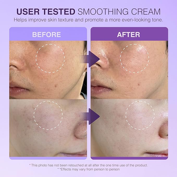 Be-Hope Vegan Luxury Comforting Cream – Soothing Moisturizer for Sensitive Skin with Purple Tea Extract, Adenosine, Plant-Based Ingredients – Anti-Wrinkle, 24-Hour Hydration – 50ml / 1.7 fl oz