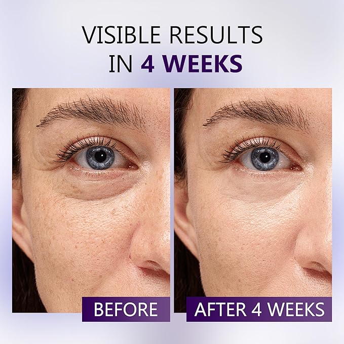 Caffeine Eye Cream for Dark Circles - 5% Caffeine Eye Serum Infused with Collagen and Niacinamide, Cream for Puffines and Bags Under Eyes w/ 360° Depuffer Roller