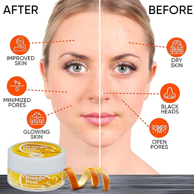 Herboganic Orange Peel Herbal Facial Scrub - Natural Citrus Exfoliants for Gentle Skin Cleansing and Rejuvenation - Suitable for All Skin Types | 5.30 oz…