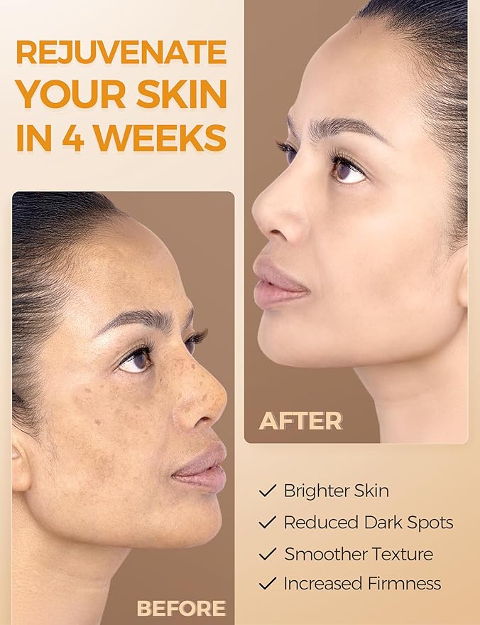 NING DERMOLOGIE Vitamin C Serum with Niacinamide & Ethyl Ascorbic Acid: Brightening, Moisturizing Face Serum for Dark Spots | Hyperpigmentation & Anti-Aging Treatment | Korean Synergy Formula 1.01oz