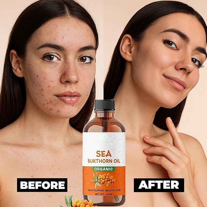 ABBASI & CO Sea Buckthorn Oil 100ml - 100% Pure, Raw, Virgin, Cold-Pressed, Non-Comedogenic, Fast-Absorbing, Skin & Hair Rejuvenation, Rich in Omega Fatty Acids & Antioxidants - Travel Size