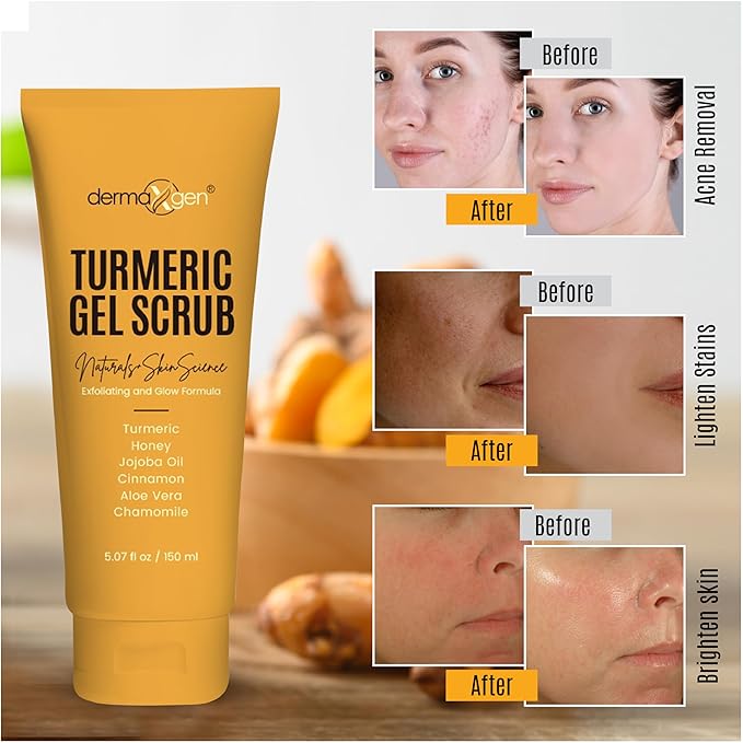 Turmeric Gel Scrub – Exfoliate, Brighten, and Refresh Your Skin with Turmeric. Achieve a Smooth, Radiant Complexion by Removing Dead Skin Cells and Impurities for a Natural Glow