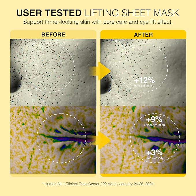 Be-Hope Vegan Luxury Mask Collection – Radiance & Pore Lifting Variants – Hydrating, Firming & Vegan Skincare Formula (Pore Lifting)