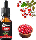Rosehip Oil for Face, Cold Pressed Rose Hip Seed Oil, Carrier Oil for Skin-1 Fl Oz (30 ml)