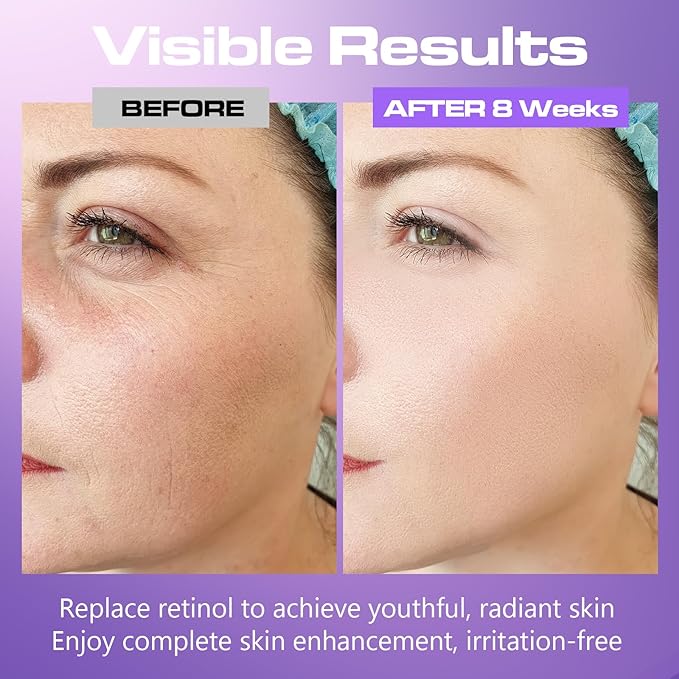 Bakuchiol Serum Concentrate, High-Potency Mix-In Bakuchiol Oil Serum, Gentle Retinol Alternative for Wrinkle Reduction, Hydrating & Firming Anti-Aging Skincare, Vegan Non-GMO, 30ml 10,000ppm