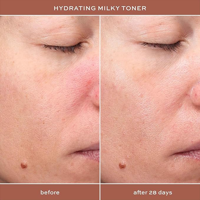 ITK Hydrating Hyaluronic Acid Milky Face Toner for Dry Skin + Redness with Green Tea + Squalane - Prep, Tone + Calm Skin for Women - Soothing Vegan Moisturizing Facial Toner - 5 oz.