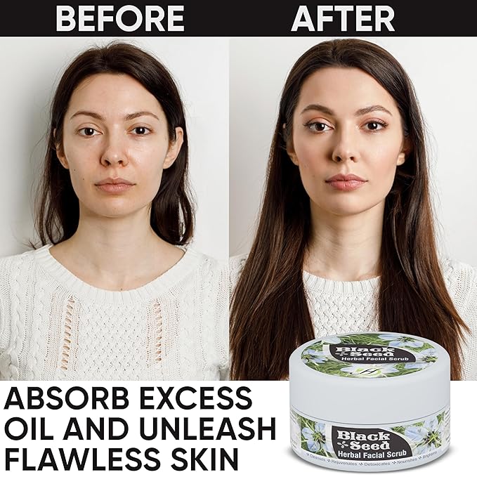 HERBOGANIC Black Seed Herbal Facial Scrub | Cleanses, Rejuvenates and Nourishes Skin | Moisturizing Facial Scrub | Facial Scrub for Women | Black Seed Facial Scrub Exfoliator | 5.30 oz