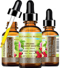 Botanical Beauty Organic ROSEHIP SEED OIL 100% Pure Natural Virgin Unrefined Cold-pressed Carrier Oil For Face, Skin, Body, Hair, Lip, Nails, Rich in vitamin C, Vitamin E, Anti-Aging (0.5 Fl Oz)