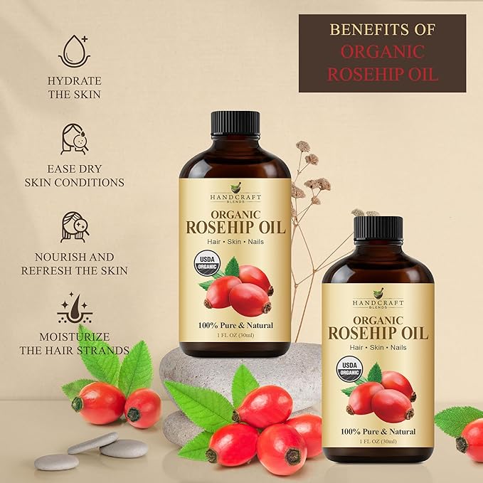 Handcraft Blends Organic Rosehip Oil - 1 Fl Oz - 100% Pure and Natural - Premium Grade Oil for Face, Skin and Hair - Protect and Nourish - Carrier Oil