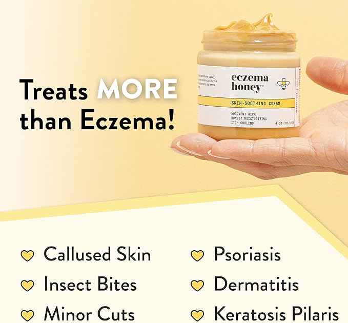 ECZEMA HONEY Original Skin-Soothing Cream - Organic Hand & Body Eczema Relief - Natural Honey Lotion for Dry, Itchy, & Irritable Skin (4 Oz) (Pack of 2)