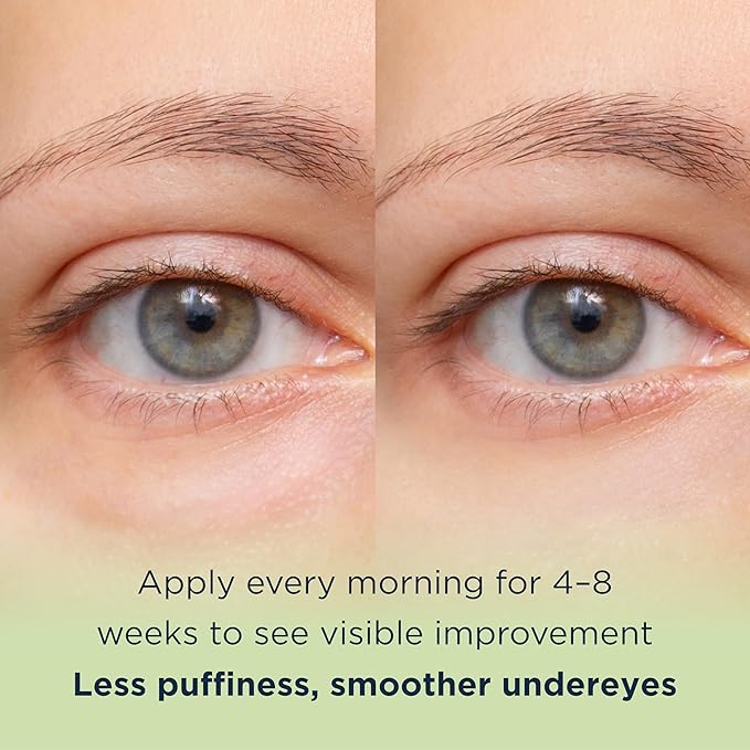 MATKAS Korean Vitamin C Under Eye Cream for Dark Circles and Puffiness 0.5 Fl. Oz. - Brightening Under Eye Cream with Caffeine for Puffy Eyes, Korean Under Eyes Brightener Moisturizer, Caffeine Serum