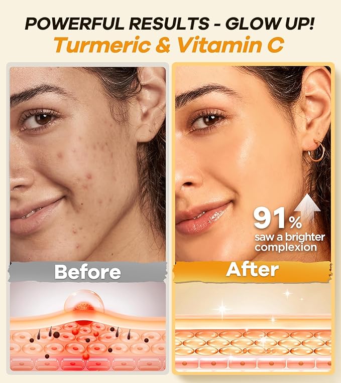Turmeric Face Scrub – Brightening & Exfoliating Facial Scrub for Glowing Skin – Natural Turmeric Exfoliator with Vitamin C & Aloe Vera – Gently Removes Dead Skin & Reduces Dark Spots – 4.23oz