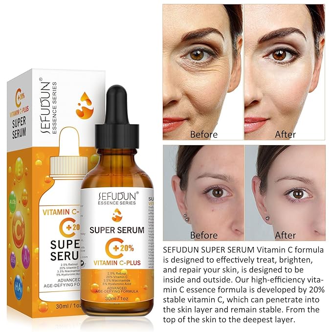 Vitamin C Serum, 20%, Retinol, Anti-Aging, For dark spots, Face Serum with Hyaluronic Acid, 1oz