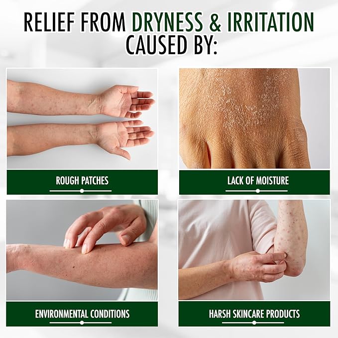 GLY MIRACLE Fragrance-Free Non-Greasy Body Lotion, 12 oz High-Glycerin Moisturizer for Sensitive, Extremely Dry Skin, Hands, Feet & Body