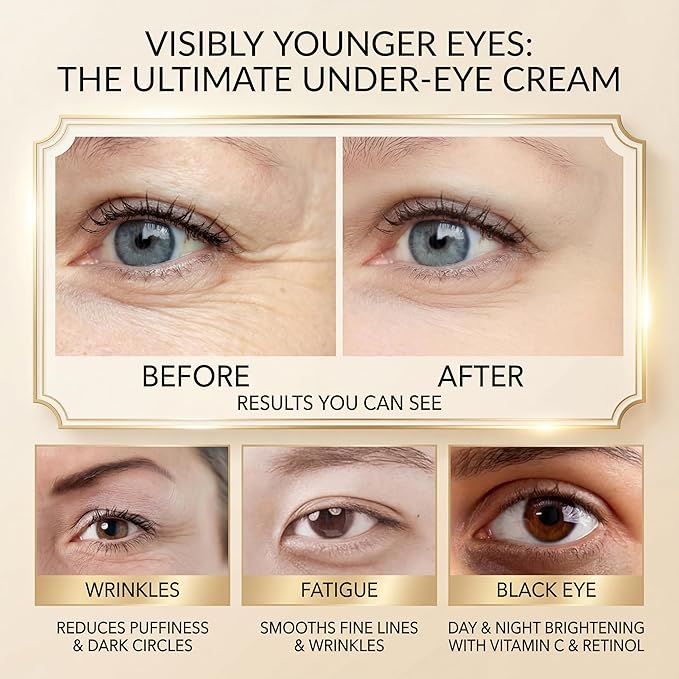 Retinol Under Eye Cream for Dark Circles, Remove Puffiness & Wrinkles, Day & Night Brightening Anti-Aging Eye Cream for Fine Lines, 0.67 Fl Oz