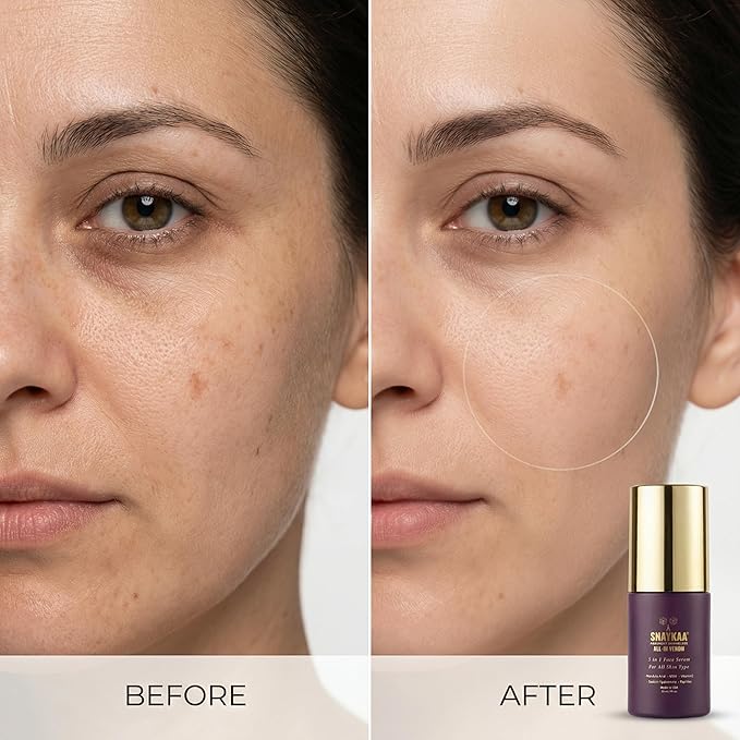 Niacinamide Vitamin C Face Serum with Hyaluronic Acid & Peptides – Brightening, Dark Spot Corrector, Anti Aging Hydrating Serum – 30 ml Made in USA