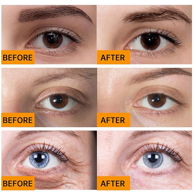 Caffeine Solution 5% + EGCG, Caffeine Eye Serum For Face, 30 ML/ 1 PCS Moisturizing Under Eye Solution For Reduces Dark Circles & Puffiness.