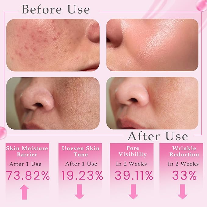 PDRN Serum (Sodium DNA) – 99% Naturally Derived Vegan Korean PDRN Pink Peptide Serum with Multi-Peptide Complex & Hyaluronic— +73.82% Barrier Support, −33% Wrinkle & −39.11% Pore Reduction(1.01 fl oz)