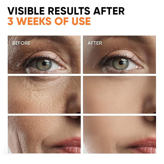 Vitamin C Serum for Face, Stem Cells, Niacinamide, Hyaluronic Acid & Vitamin E - Anti-Aging Retinol Facial Serum with Glycolic Acid & Retinal for Brightening, Hydrating & Firming Skin - Made in USA