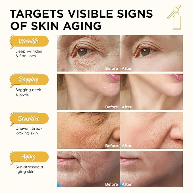 Advanced Peptide Firming Serum: Olivita Liquid Solution Serum with Matrixyl 3000, Matrixyl Synthe-6 & Argireline, Collagen Peptides for Wrinkles, Sagging & Loss of Firmness