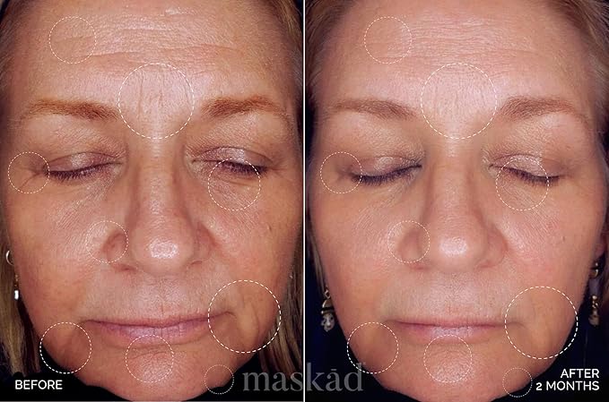 MASKĀD® K-Beauty Anti-Aging Peptide Serum for Face - Korean Skincare Growth Factor Serum for Wrinkles, Fine Lines - Hydrating Glow - Clean Beauty, Sensitive Skin - XL 2oz