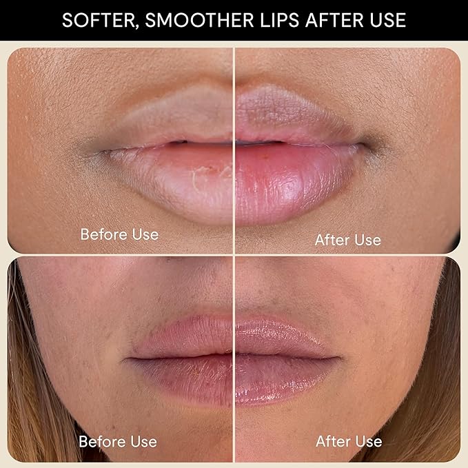 Silly George Lip Balm Recovery - Hydrating Overnight Mask for Dry Lips, Plush Replenisher with Shea Butter, Squalane & Vitamins, 10g