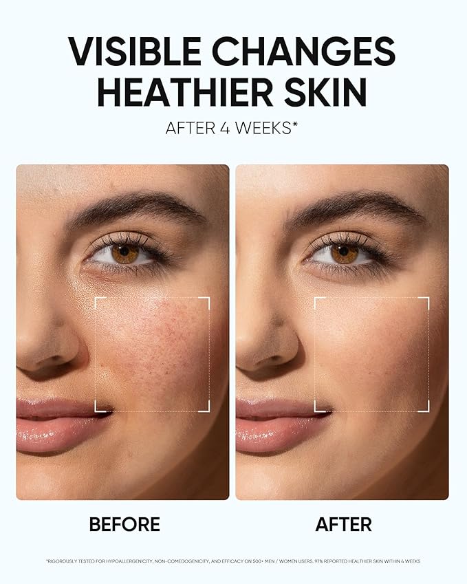 SKINTIFIC Face Moisturizer with 5X Ceramides, Hydrating Moisture Barrier Repair Cream for Sensitive/Oil Skin Types, Hyaluronic Acid & Centella, Daily Facial Moisturizer, Non-Comedogenic 100g/3.52 OZ