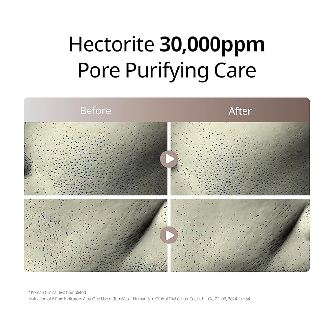 Terra Vita Mild Deep Cleansing Foam, Cleanses Without Stripping Sensitive Skin, PDRN & Hectorite 10,000ppm, Deep Pore Purifying, Developed with Korean Professional Estheticians | 5.07 fl. oz.