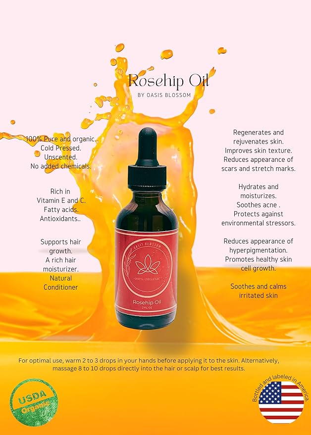 Rosehip Oil for Face, Skin & Hair| 100% Pure Certified USDA Organic | Cold Pressed Unrefined Rosehip Oil | Hydrating, Moisturizing, Nourishing, Anti-Aging | 2 Fl Oz.