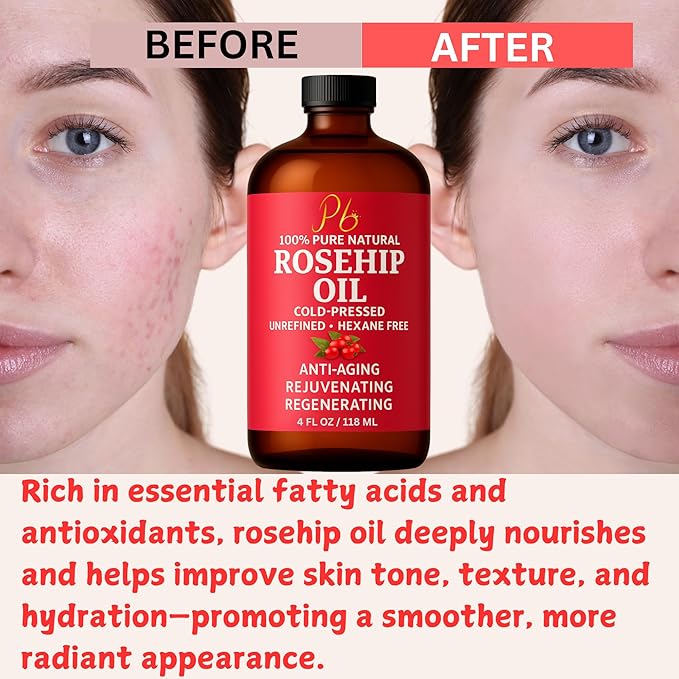Pomberries Rosehip Seed Oil – Cold-Pressed & Unrefined, Rosehip Oil for Face, Skin & Hair – Rose Hip oil for Scars, Wrinkles, Stretch Marks, Daily Hydration & Gua Sha Massage, 4 fl oz