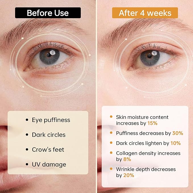 5% Caffeine Eye Serum with 360° Roller,Under Eye Cream for Dark Circles, Puffiness & Puffy Bags, Wrinkles Fine Lines, Eyes Cream for Men and Women 0.51 fl oz