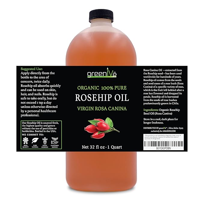 GreenIVe Organically Grown Rosehip Oil Rosa Canina 100% Pure Cold Pressed Virgin Oil (32 Ounce)